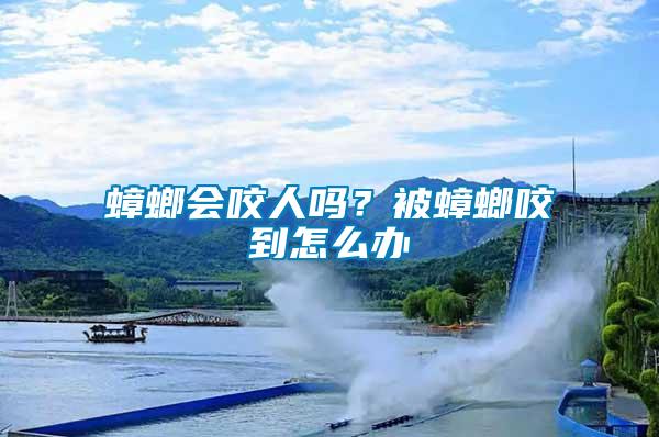 蟑螂會咬人嗎？被蟑螂咬到怎么辦